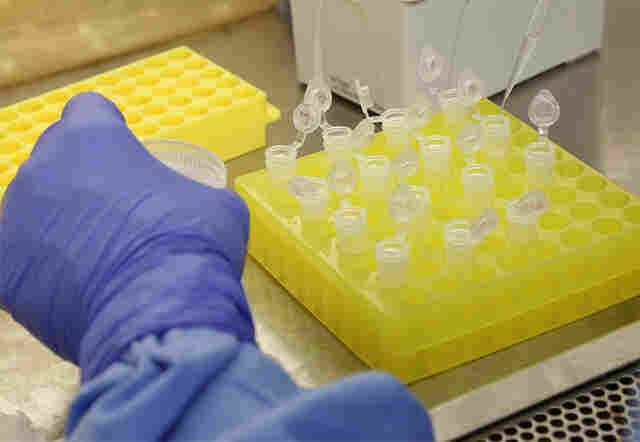 Agevisa confirma 13 casos suspeitos de Coronavírus em Rondônia; 8 só em Ariquemes