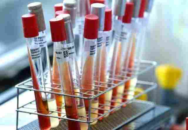 Casos suspeitos de Coronavírus em Rondônia sobem para 114; 63 em Porto Velho