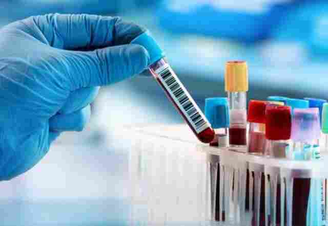 Rondônia: 163 casos suspeitos de Coronavírus; 89 na Capital