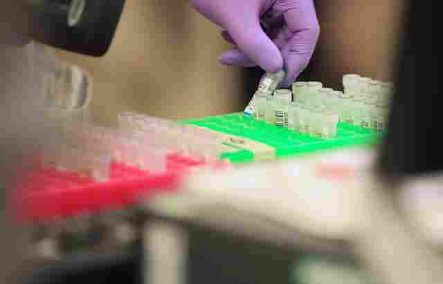 Governo explica motivos para não divulgar dados sobre Coronavírus em Rondônia