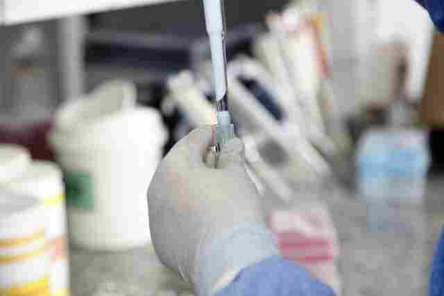 Rondônia chega a 6 casos de Coronavírus; mulher de 31 anos teve infecção local