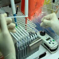 Coronavírus: coletas realizadas em Rondônia aguardam kits do Ministério da Saúde