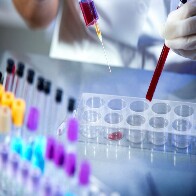 Prefeitura da Capital vai comprar 10 mil kits de exames para Coronavírus