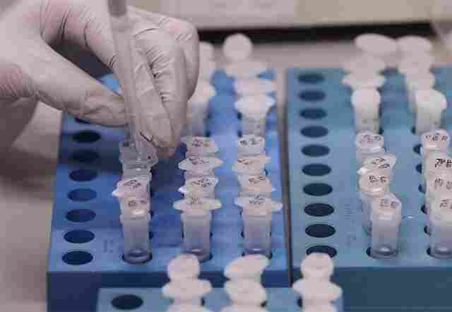 Porto Velho tem novo caso de Coronavírus, diz Semusa