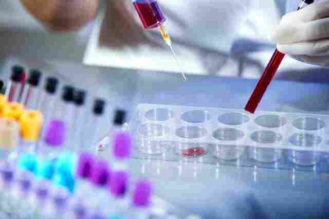 Porto Velho tem 21 casos de Coronavírus