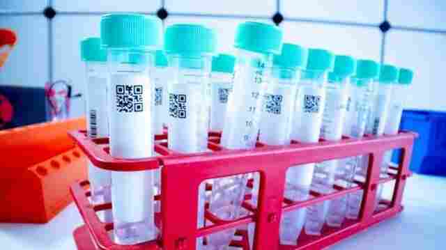 Rondônia chega a 654 casos de Coronavírus com 23 mortos; curados somam 154