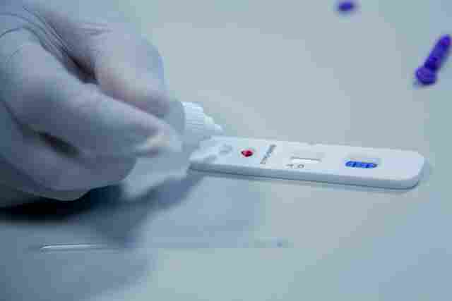 Governo oficializa entrega de 100 mil testes rápidos para distribuição aos municípios