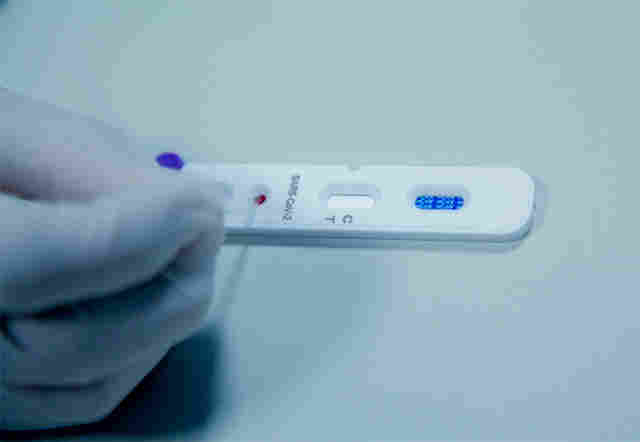 Coronavírus: Rondônia começa testes em massa da população em todos os municípios