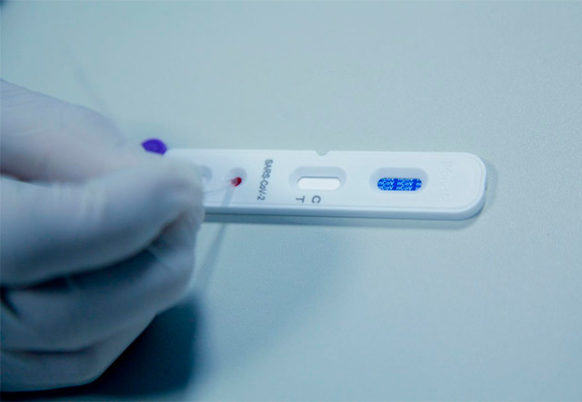 Coronavírus: Rondônia começa testes em massa da população em todos os municípios