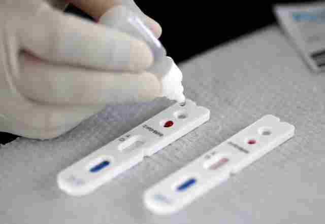 ANS torna obrigatória cobertura de teste para Coronavírus por planos de saúde