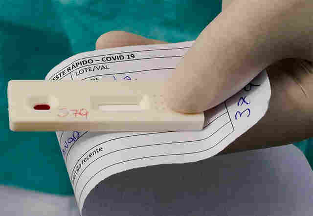 Servidor com Coronavírus poderá pedir carência de 90 dias no pagamento do consignado