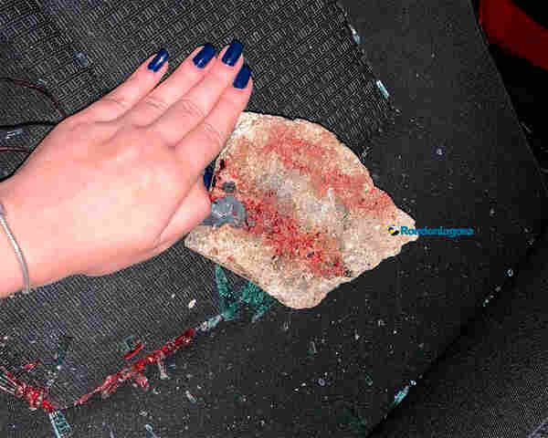 Estudante leva pedrada na cabeça e fica em estado grave