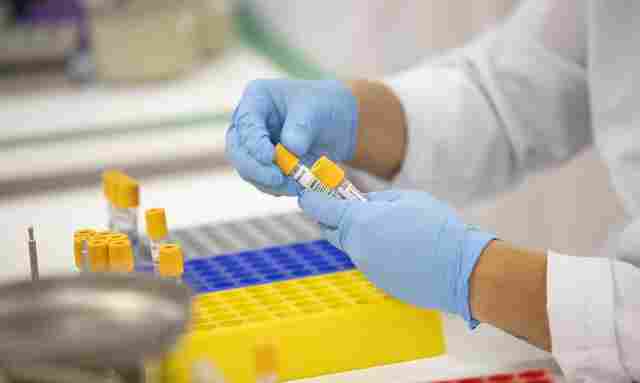 Hospital de São Paulo investiga 16 pacientes suspeitos de reinfecção por covid-19