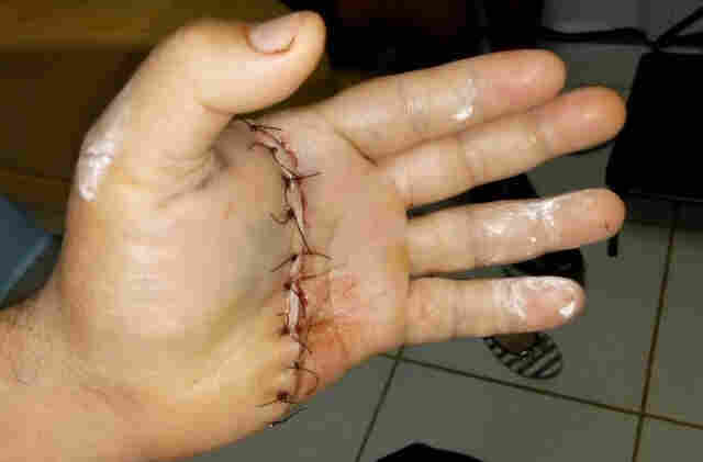 Cabo da PM passa por cirurgia após ataque de idoso