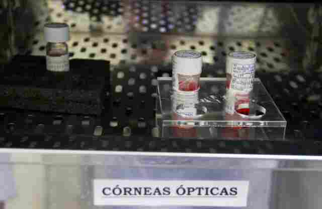 Banco de Olhos do HB retoma a captação de córneas a partir de doadores falecidos