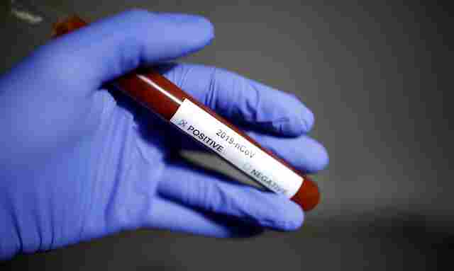 Fiocruz explica como pessoas que tiveram Covid-19 podem ser reinfectadas