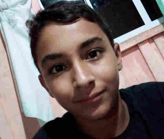 Família pede ajuda para tratamento de adolescente que teve corpo queimado em  Rio Pardo