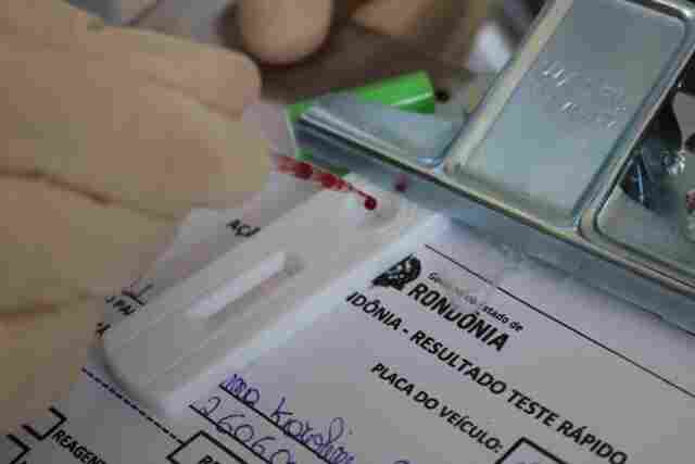 Mais 33 mortes por Coronavírus em Rondônia nesta sexta-feira