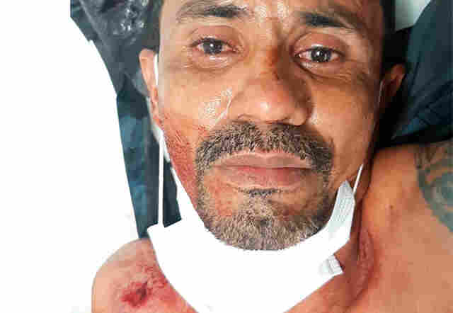 Acusado de matar jovem é preso após bater em viaturas e atirar em policiais na Capital