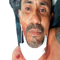 Acusado de matar jovem é preso após bater em viaturas e atirar em policiais na Capital