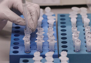 Rondônia registra 7 mortes por Coronavírus na terça-feira