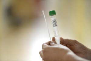 Rondônia registra 10 mortes por Coronavírus e 282 casos nesta quarta-feira