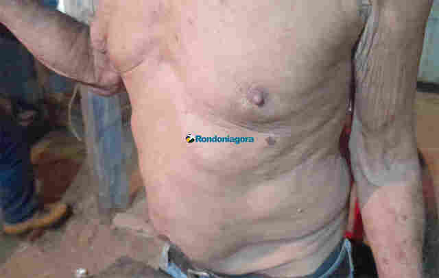 Ladrões espancam e roubam idoso em busca de armas e dinheiro