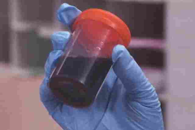 Doença “urina preta” pode estar relacionada a consumo de frutos do mar e peixes não inspecionados