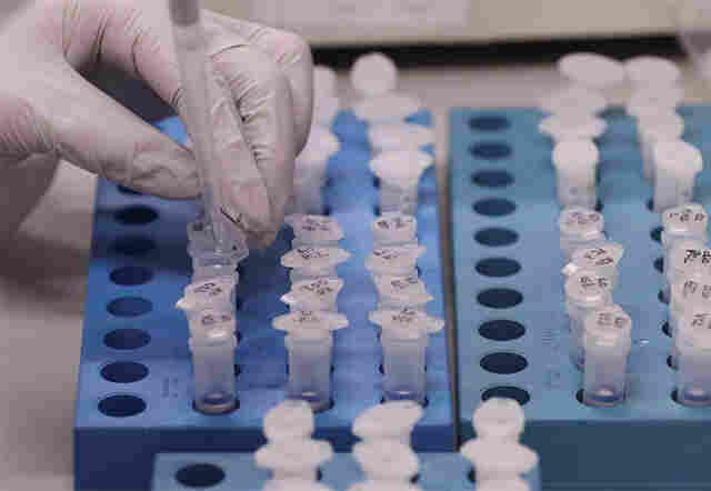 Rondônia registra 2671 casos de covid-19 e quatro mortes nesta terça-feira