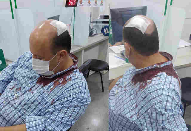 “Zezinho do Maria Fumaça” é agredido durante assalto na capital