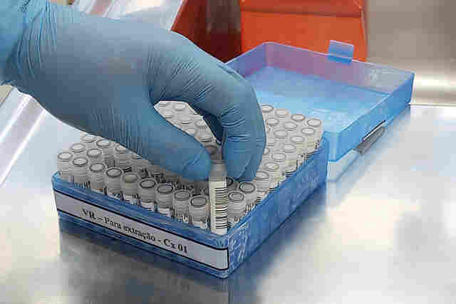 Rondônia registra 400 casos de covid-19 e uma morte neste domingo