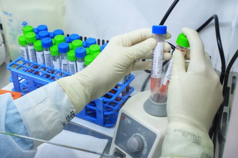 Rondônia registra 468 casos de covid-19 e quatro mortes neste domingo