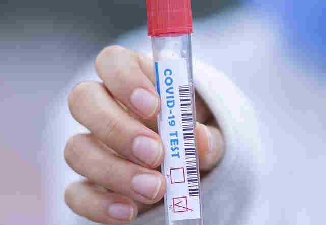 Mil casos de covid-19 e duas mortes são registrados em Rondônia nesta terça-feira