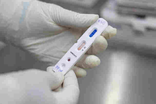 Rondônia registra 828 casos de covid-19 e quatro mortes nesta quinta-feira