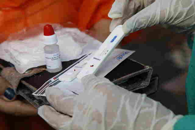 Rondônia registra três mortes por covid-19 e 210 casos nesta terça-feira