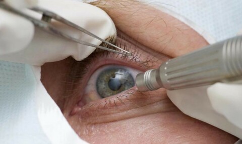 Após casos em Rondônia, Conselho alerta para importância de cuidados em mutirões oftalmológicos