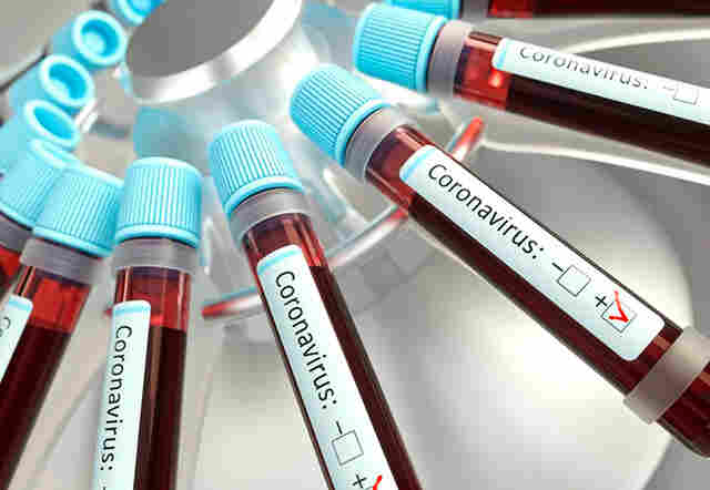 Rondônia registra 686 casos de covid-19 e uma morte neste sábado