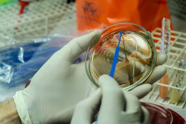 Casos suspeitos de varíola do macaco em Rondônia são descartados