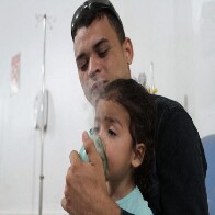 Sesau alerta sobre doenças respiratórias ocasionadas pelas queimadas