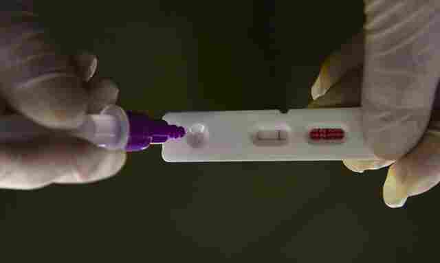 Hospitalizações por covid-19 mantêm tendência de alta nos estados
