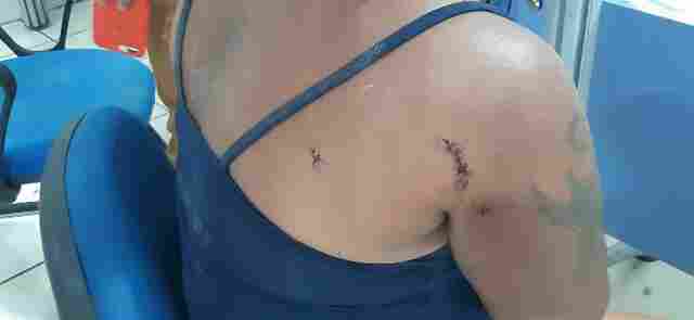 Homem ataca mulher a facadas durante bebedeira e foge para casa da mãe