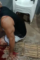 Vendedor de espetinhos atacado a tiros apontou vigilante como suspeito do crime