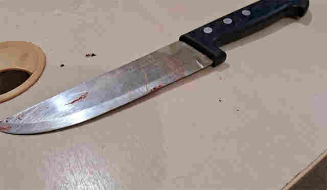 Mulher é esfaqueada na cabeça pela filha durante briga