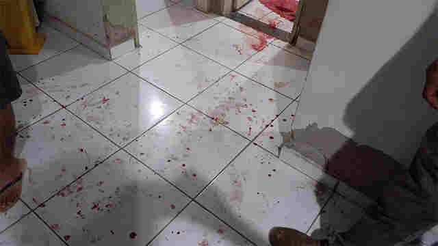 Idoso reage a assalto e é agredido com coronhadas na Zona Sul