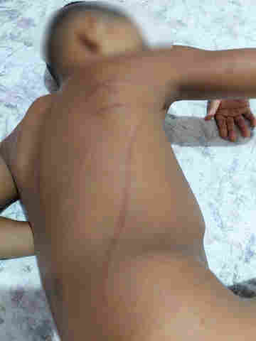 Mãe vai a Polícia denunciar pai que espancou criança de 4 anos