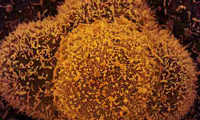 Nova subvariante da covid-19 é identificada em Mato Grosso
