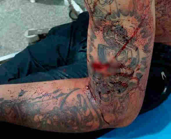 Jovem é atacado a facadas por negar romance em festa na capital