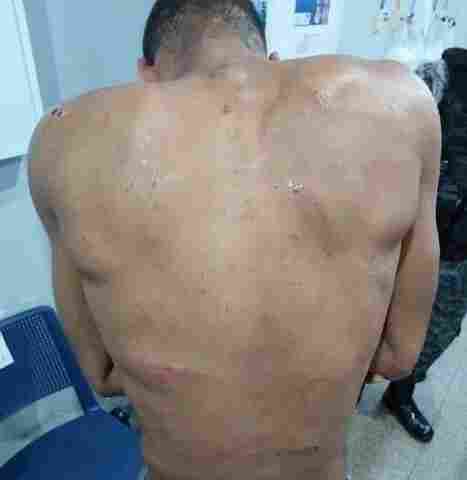 Ladrão cai do telhado e é dominado por moradores ao tentar roubar 700 metros de fio