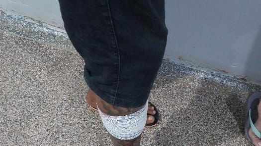 Adolescente cabeleireiro é atacado a tiros enquanto ia atender cliente na zona leste