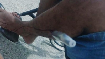 Homem é esfaqueado pela esposa adolescente após festa em Porto Velho